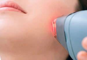 Side Effects and Contraindications of Laser Hair Removal