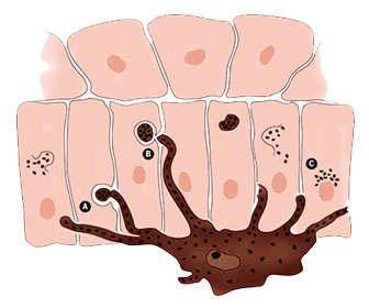 How Melanin Forms in the Skin: Process and Synthesis