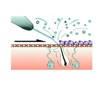 maquina peeling funcionamiento